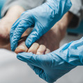 The Evolution of Podiatry: From Misconceptions to a Recognized Medical Specialty