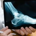 Podiatry vs. Medical School: Which Path is Right for You?