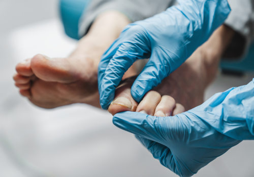 The Evolution of Podiatry: From Misconceptions to a Recognized Medical Specialty