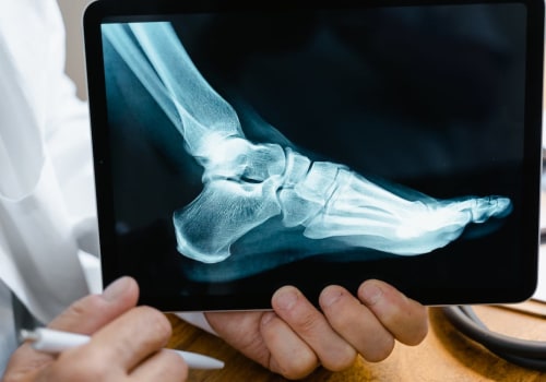 Podiatry vs. Medical School: Which Path is Right for You?